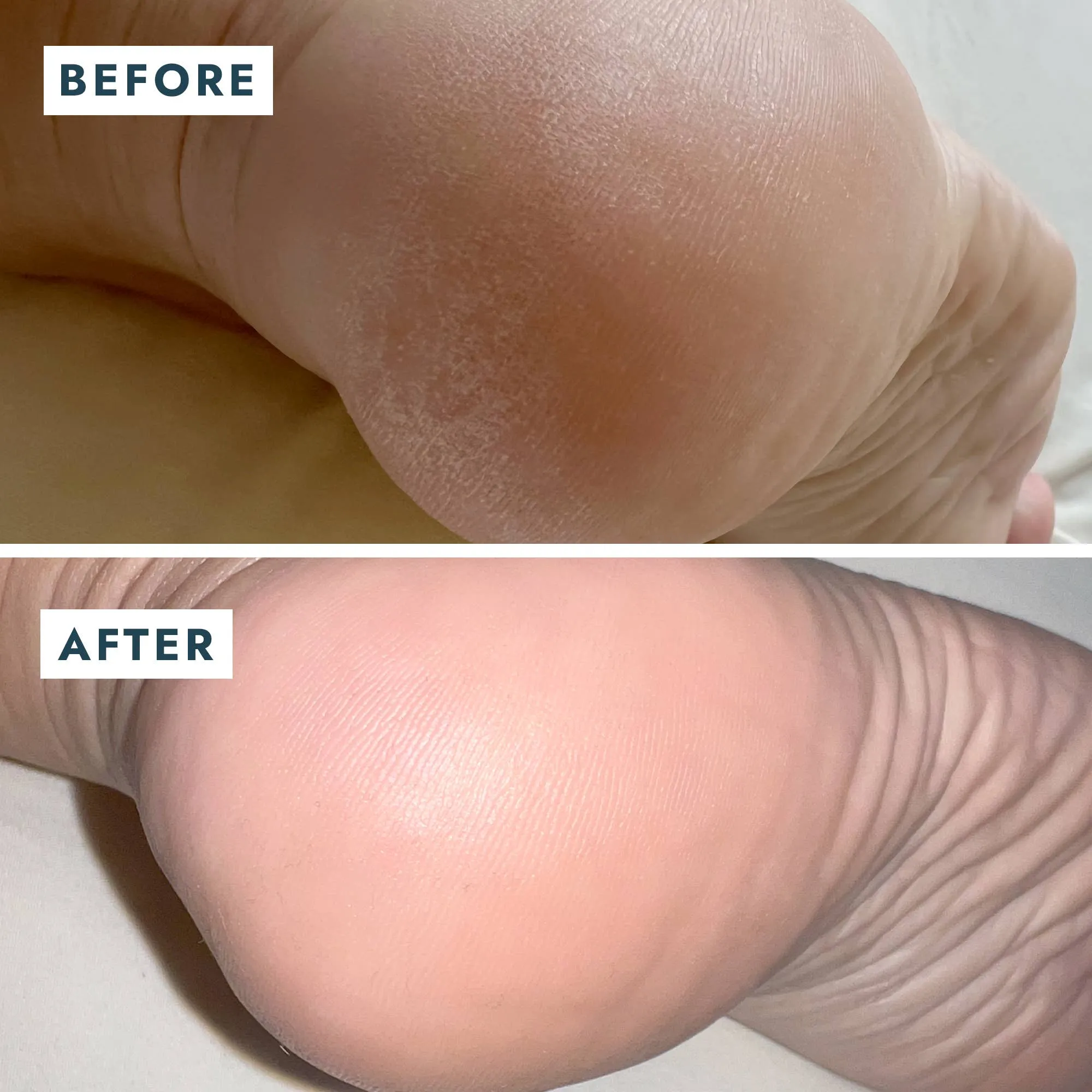 Solemate Heel Repair Balm - Mint