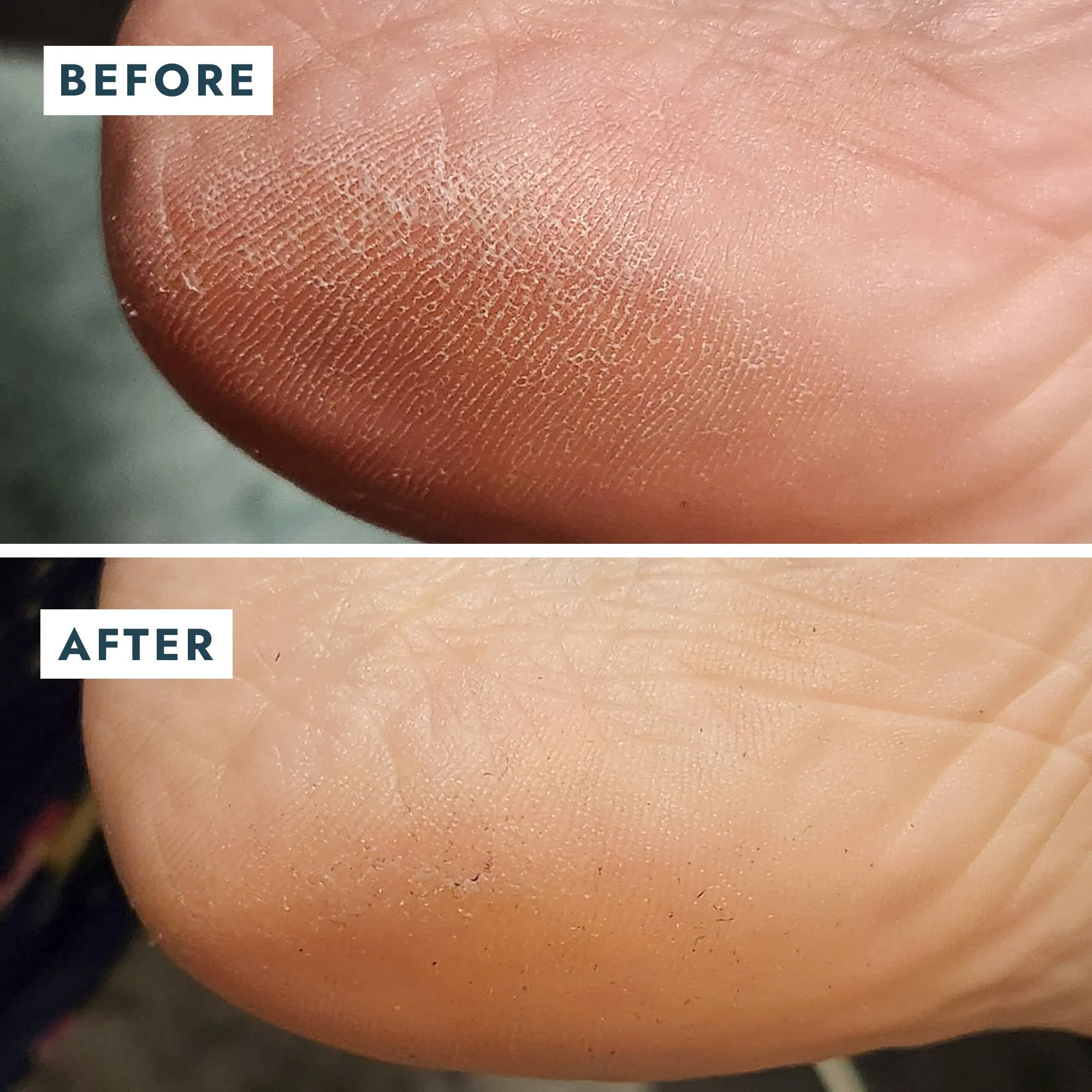 Solemate Heel Repair Balm - Mint